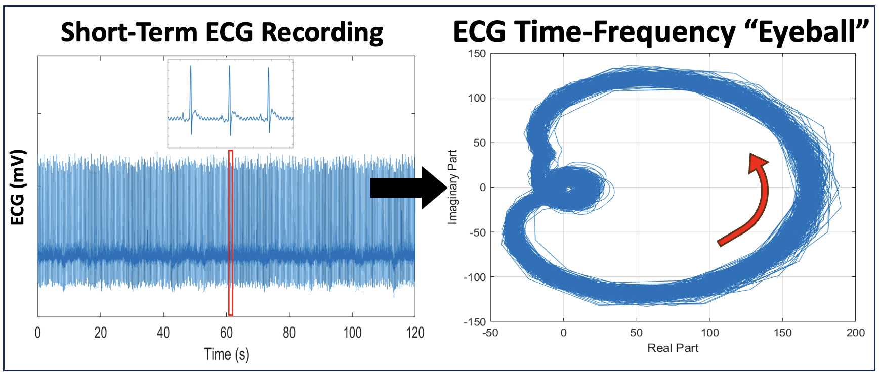 ECG Time-Frequency Eyeball