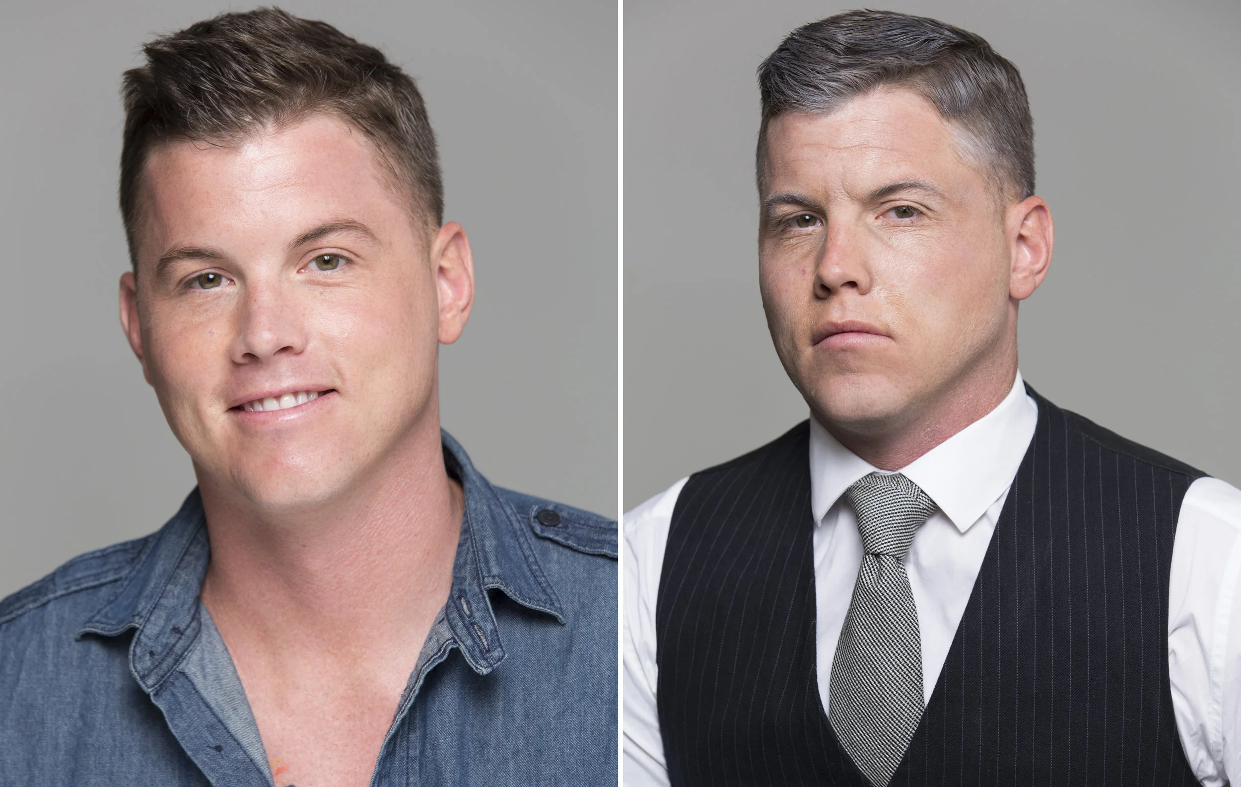 Aging Before & After