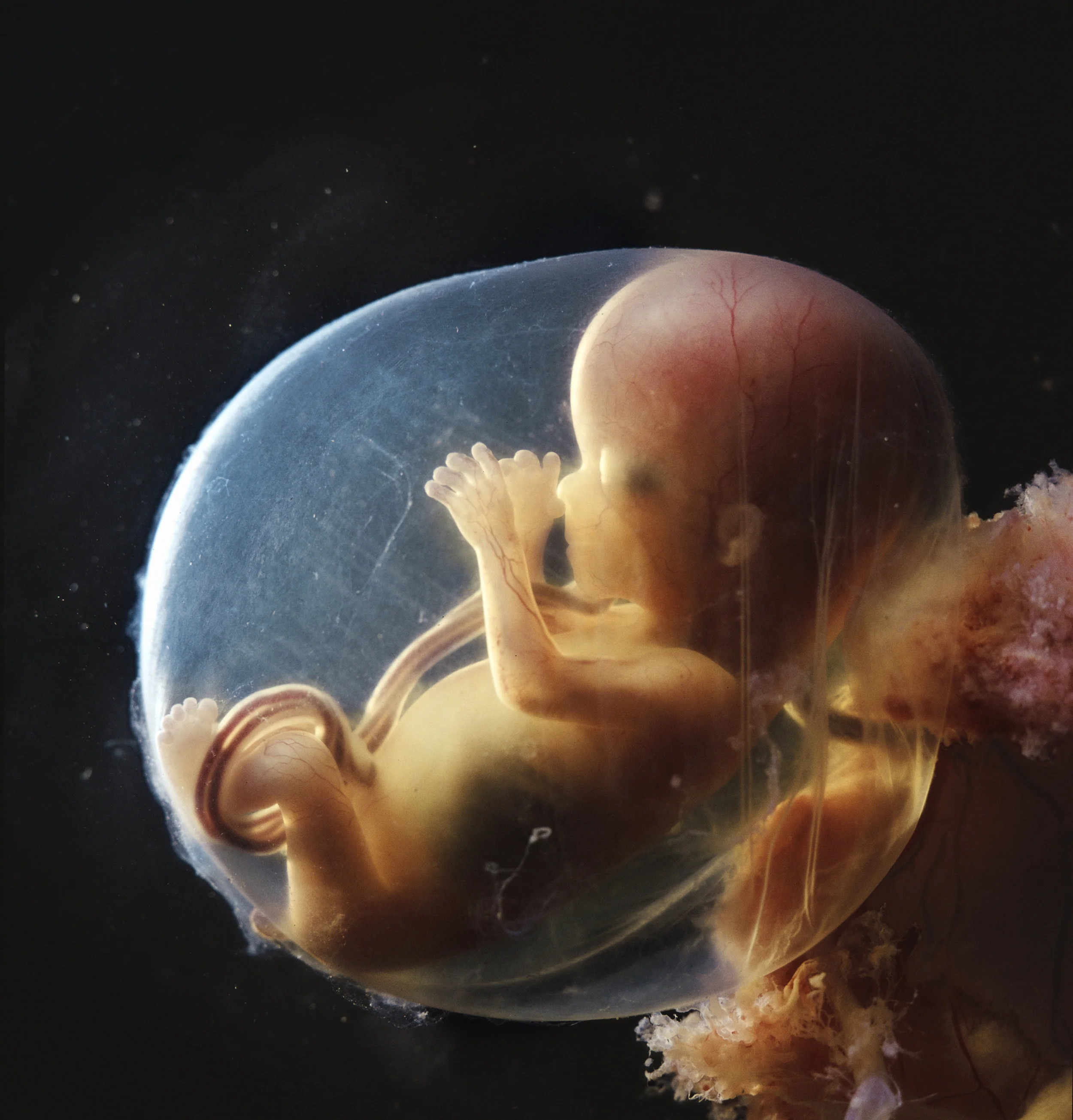 Fetus_16veckor_1965.jpg