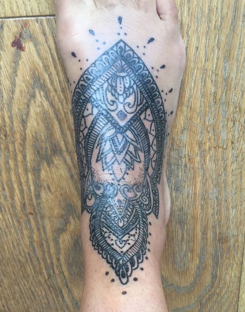 After 1 week. Still healing.