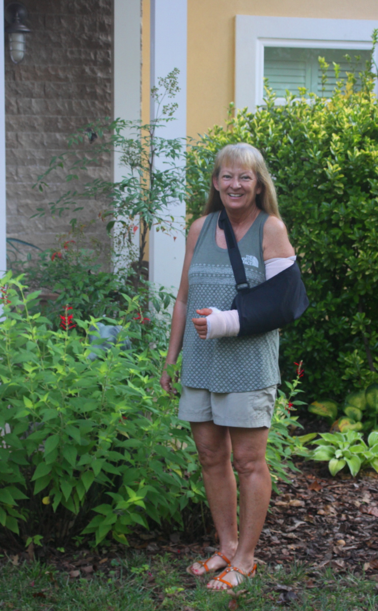 Day 2 after surgery on left wrist & elbow september2018 email.jpg