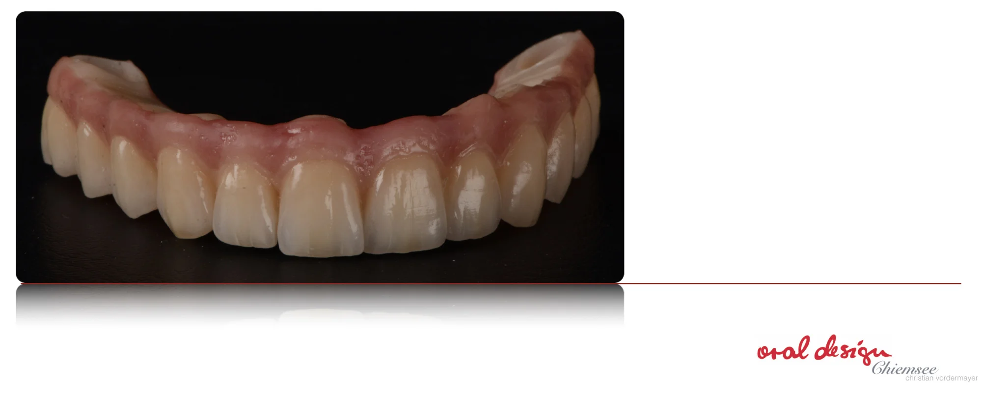 Implantatbru¦êcke2.jpg