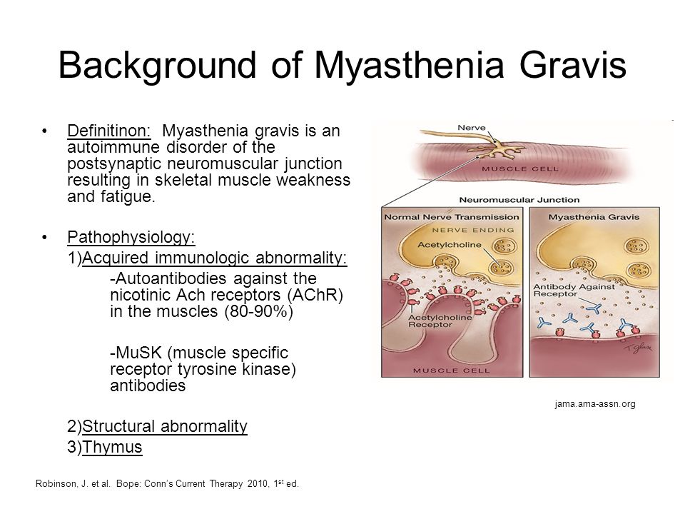 Myasthenia+Gravis.jpg