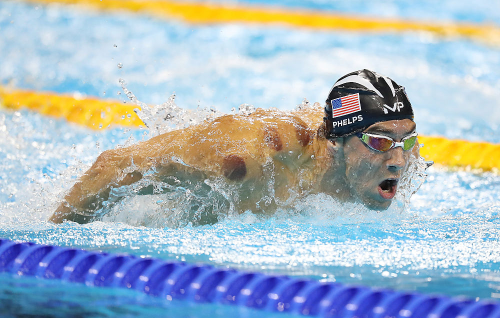 Michael Phelps competing after cupping treatment
