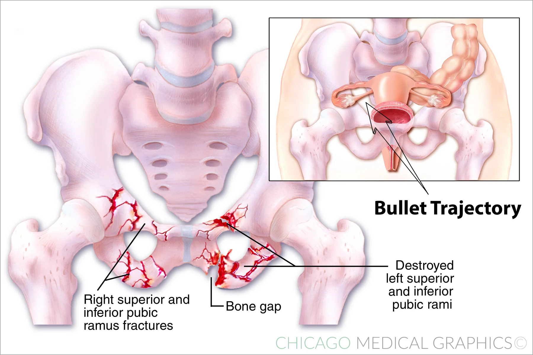 Bullet Trajectory