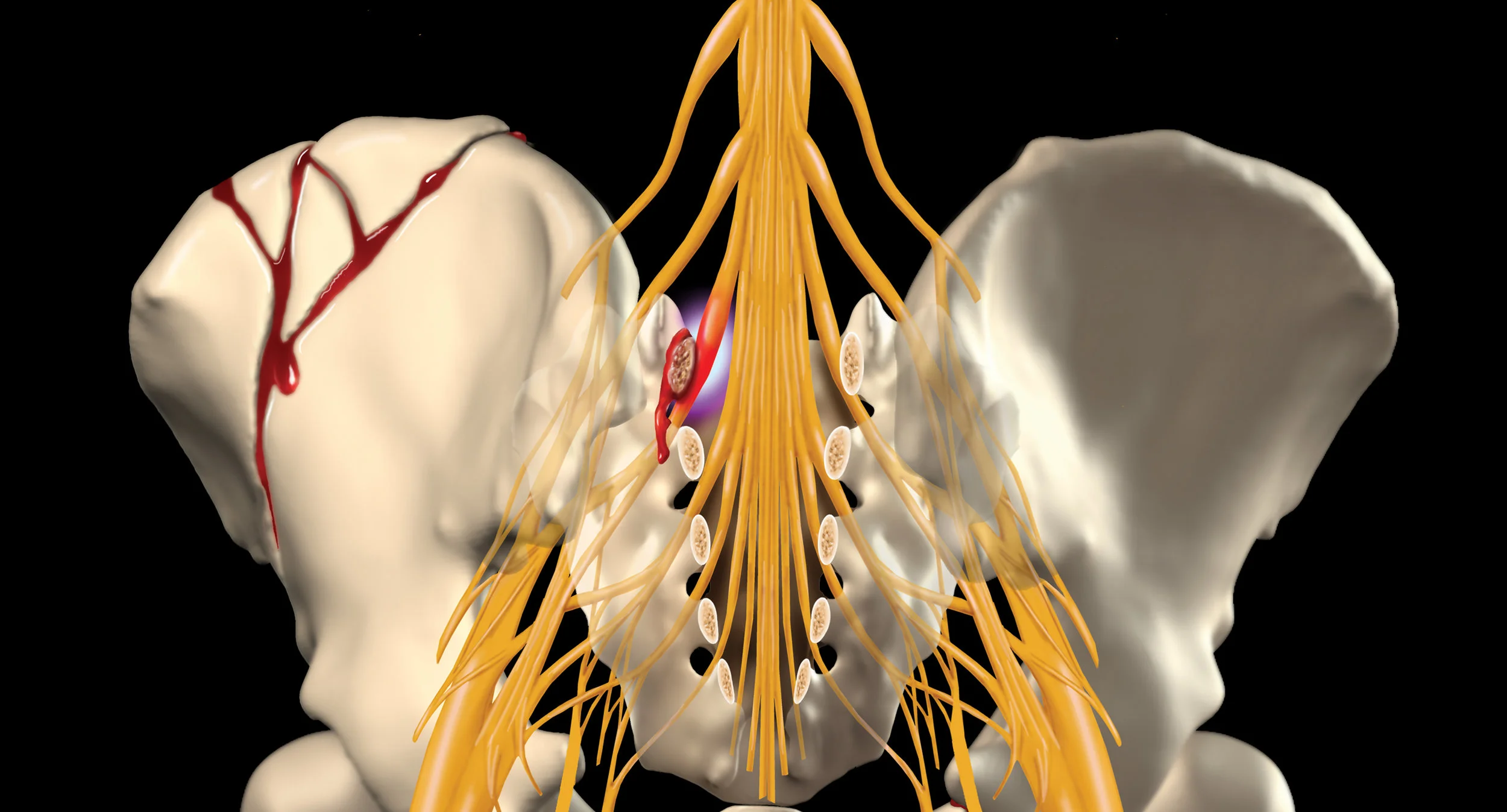 CMG Pelvis Banner Layers.jpg