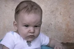 Top 3 Symptoms of Colic - With Special Guest Dr. Dennis Scharenberg