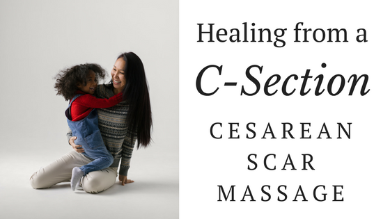Healing From a C-Section: Cesarean Scar Massage