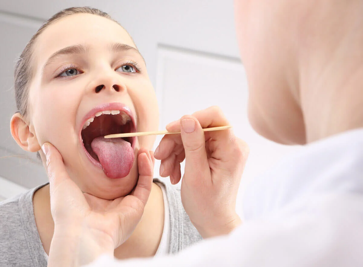 Do I Need to Have My Tonsils Removed?