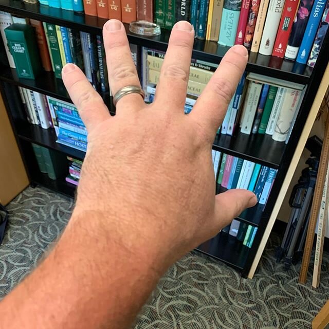 The nitrile glove farmer’s tan.