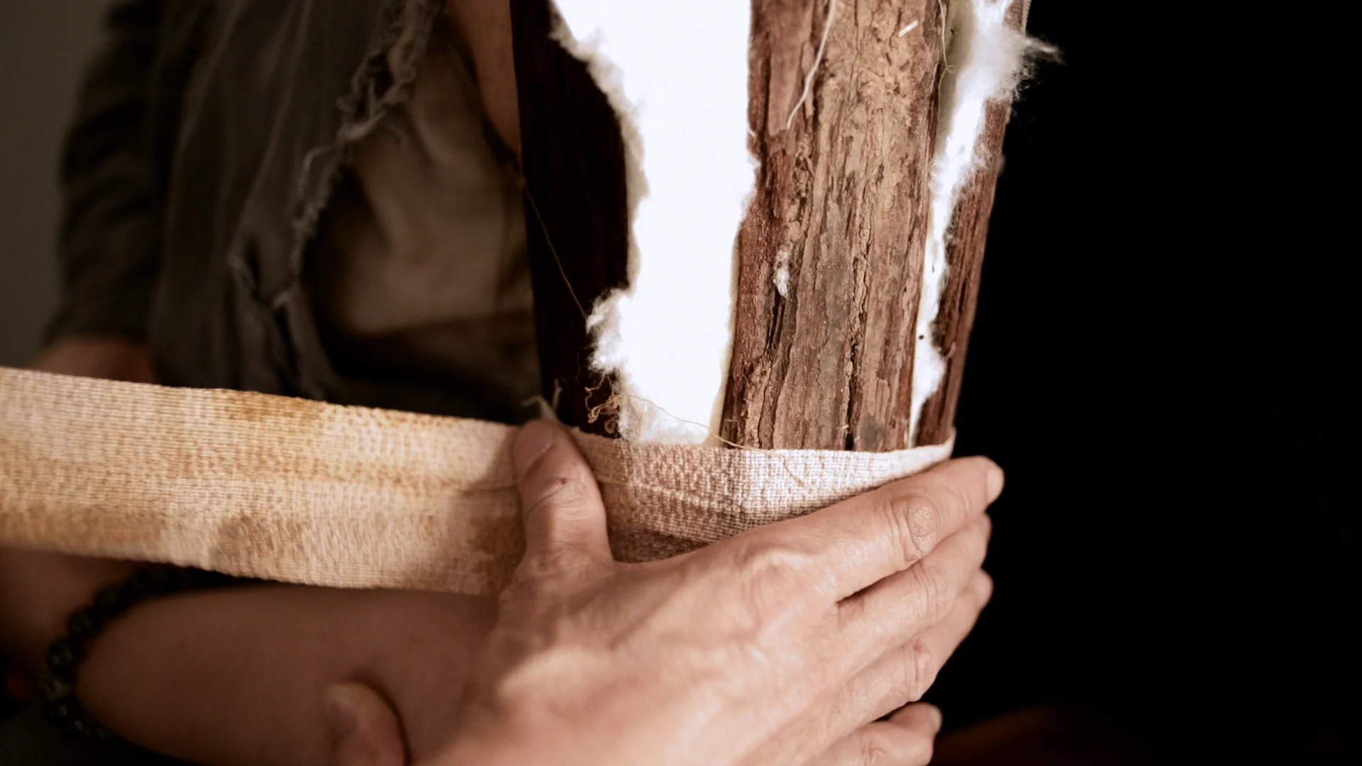 Ming treating patient with broken bone.jpg