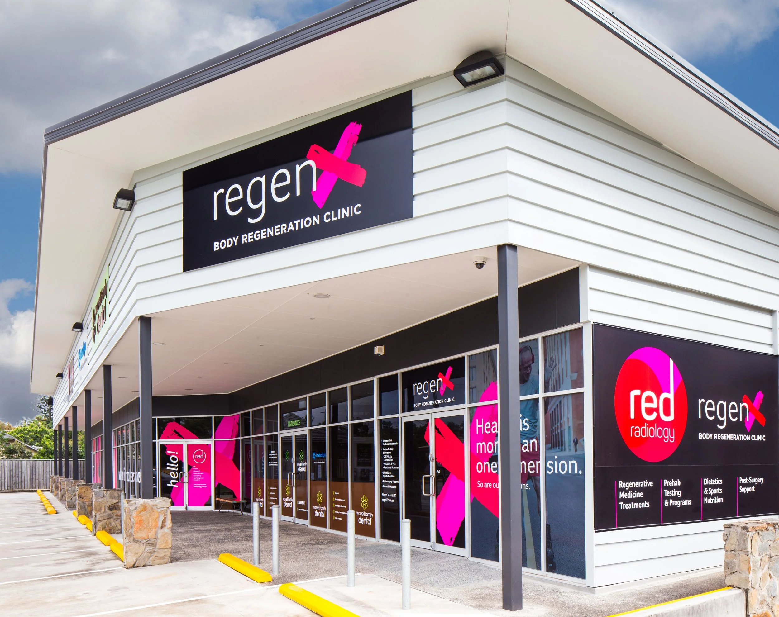 RegenX_External.jpg