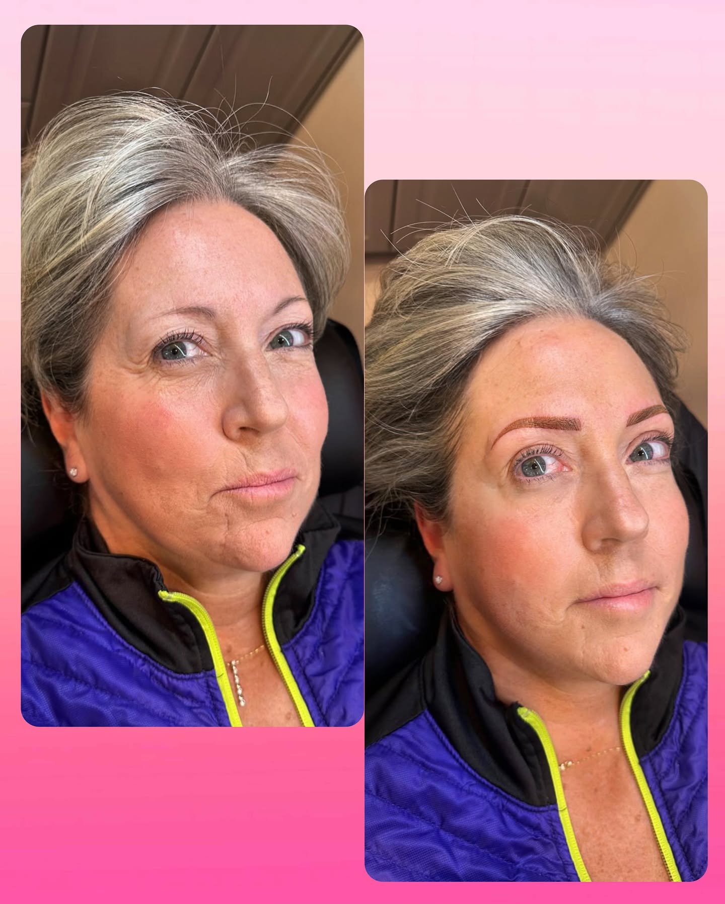 &ldquo;Will permanent makeup brows look weird with light or gray hair?&rdquo; NOPE! Whether you are 15 or 50, fuller brows are more youthful brows! 🤩 They can even help to camouflage scars or wrinkles in the brow.
PMU Powder Brows