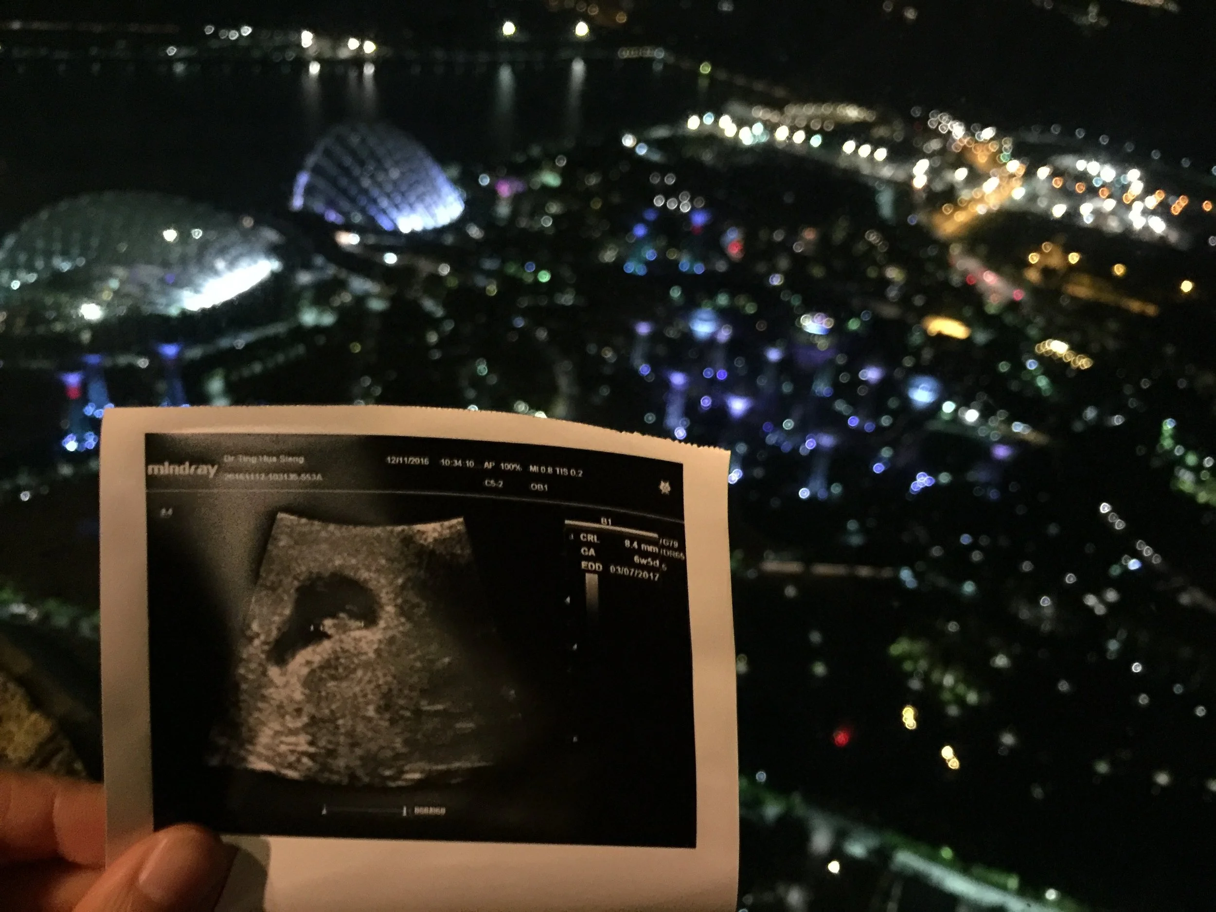 First Prenatal Check Up