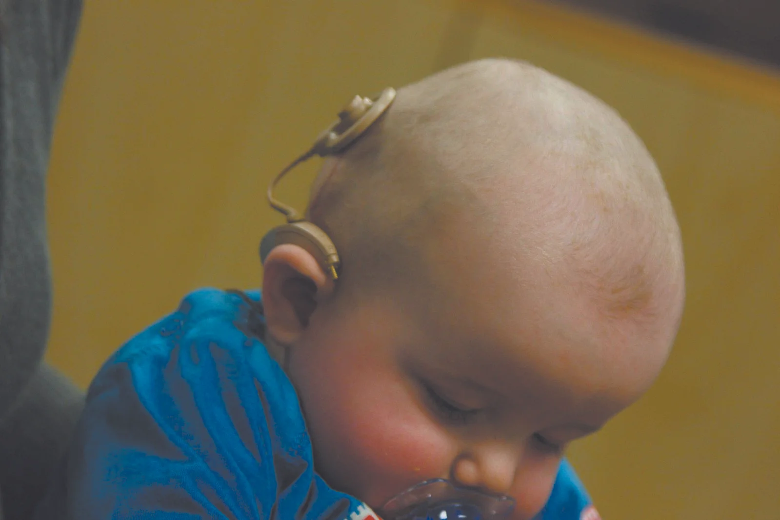 Issues - Cochlear Implants - cr. google free.jpg