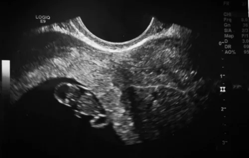 Arm buds at 7 1/2 weeks!