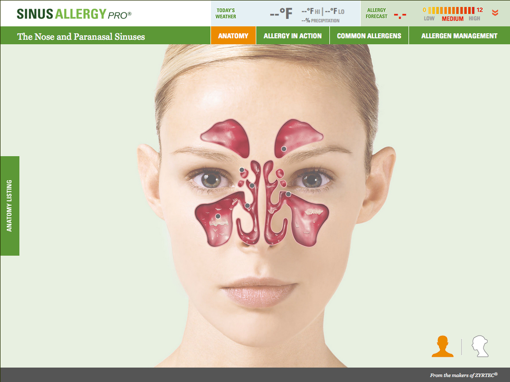 Sinus1.jpg
