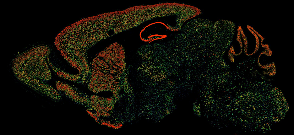Calcineurin expression in the rodent brain (Allen Brain Atlas)