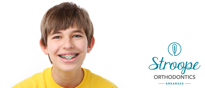 Braces smile Stroope Orthodontics
