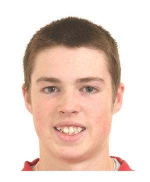 Boy with crooked teeth
