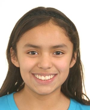 Girl with crooked front teeth