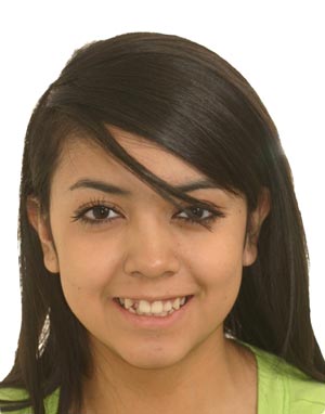 Young girl with snaggle tooth
