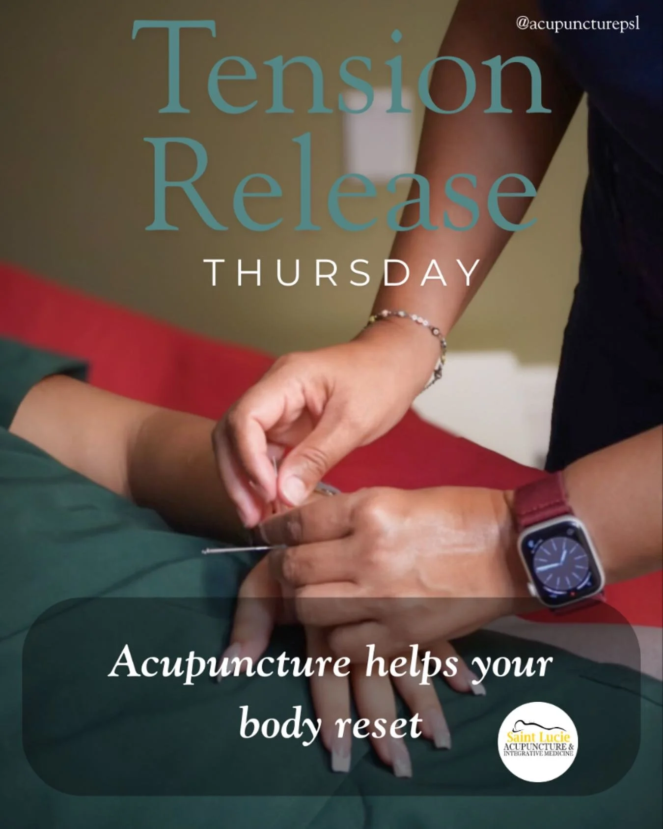 Sometimes all it takes is one gentle point to help your whole body exhale.
Acupuncture releases tension, supports circulation, and brings your body back into balance — one needle at a time. ๐ฟ
#AcupunctureBenefits #TensionRelief #NaturalHealin