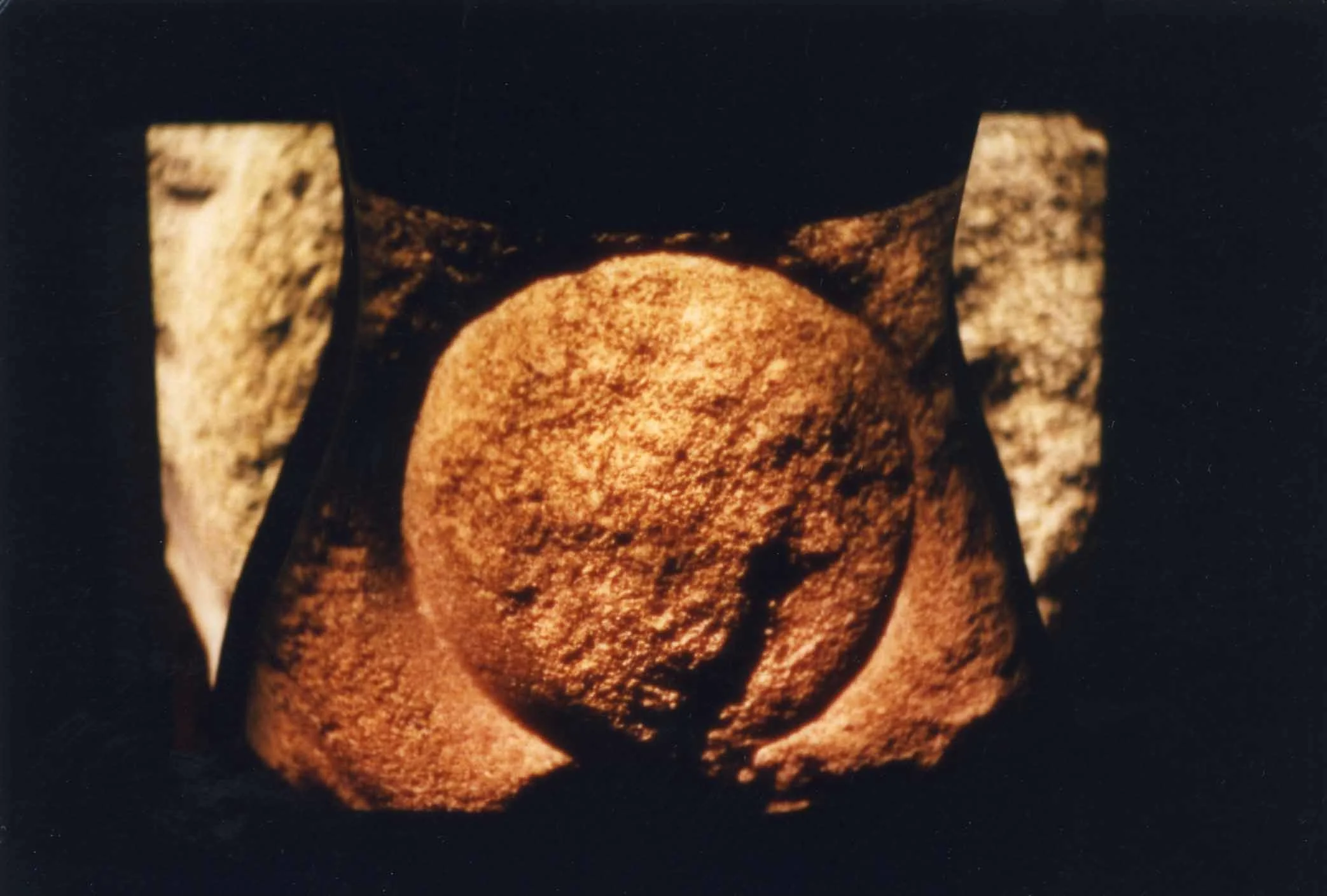  Bauch-Projektion mit Kreis-Stein, Foto 