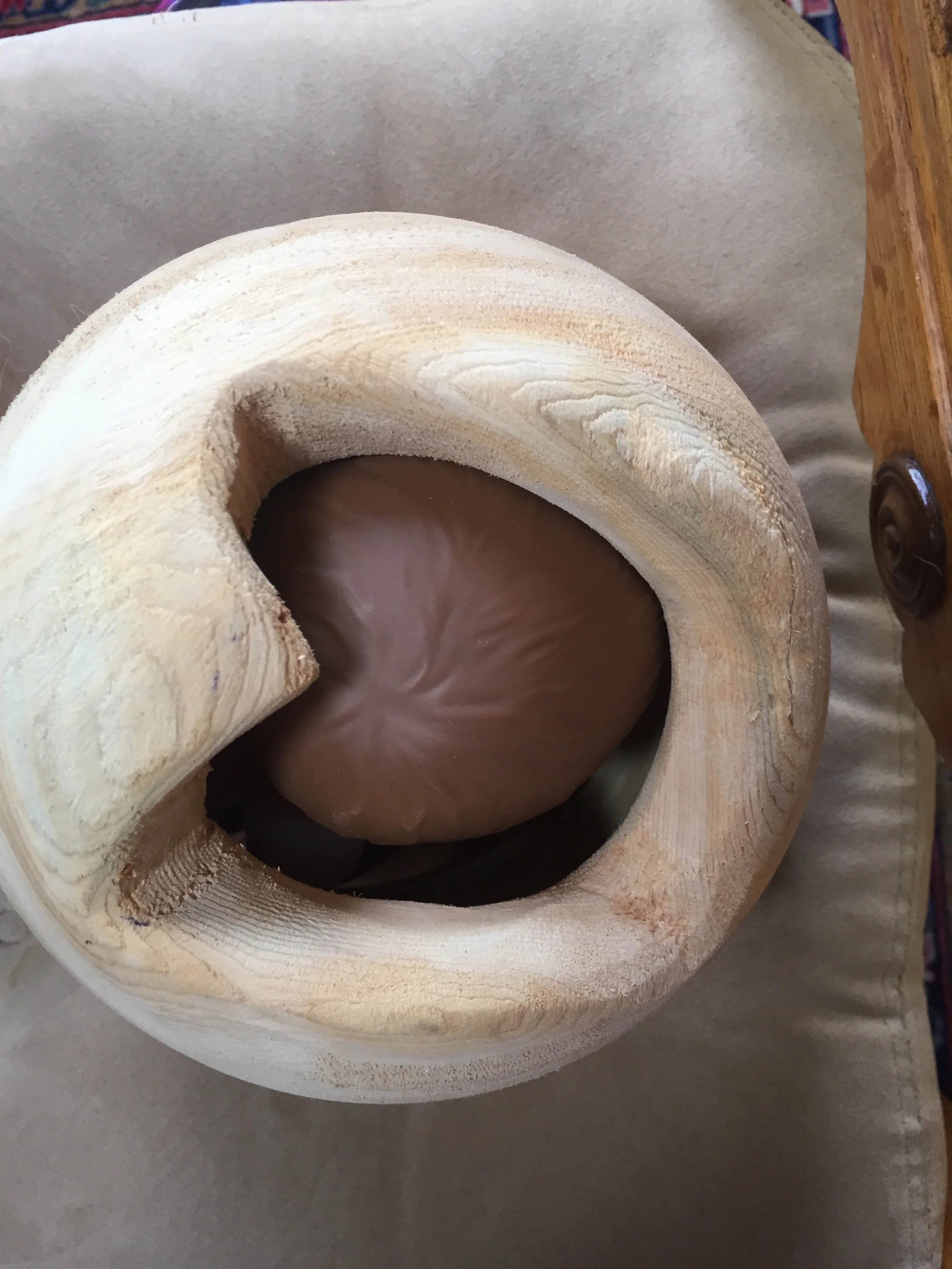 UNDERSTANDING THIS COULD CHANGE EVERYTHING This is an intentionally simplified, easily understood educational tool that shows the cause of obstructed labor— the head of the infant is too large to pass through the pelvic outlet.