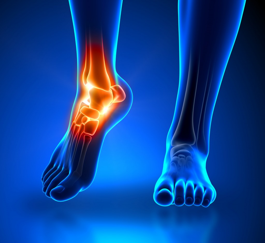 Ankle and Foot Pain