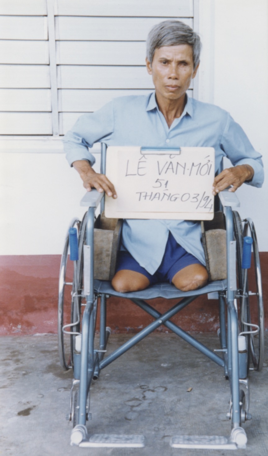 VNAH 1994 Amputees - 05.jpeg