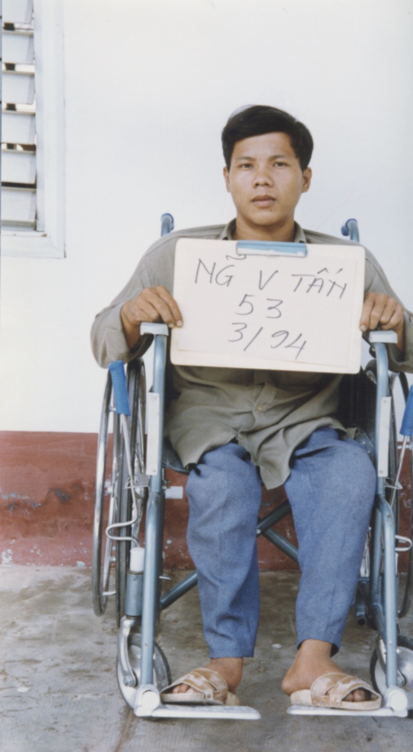 VNAH 1994 Amputees - 07.jpeg