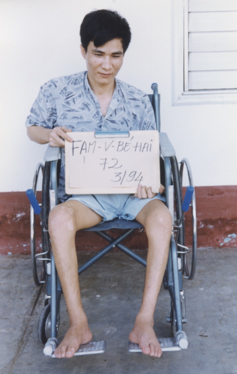 VNAH 1994 Amputees - 24.jpeg