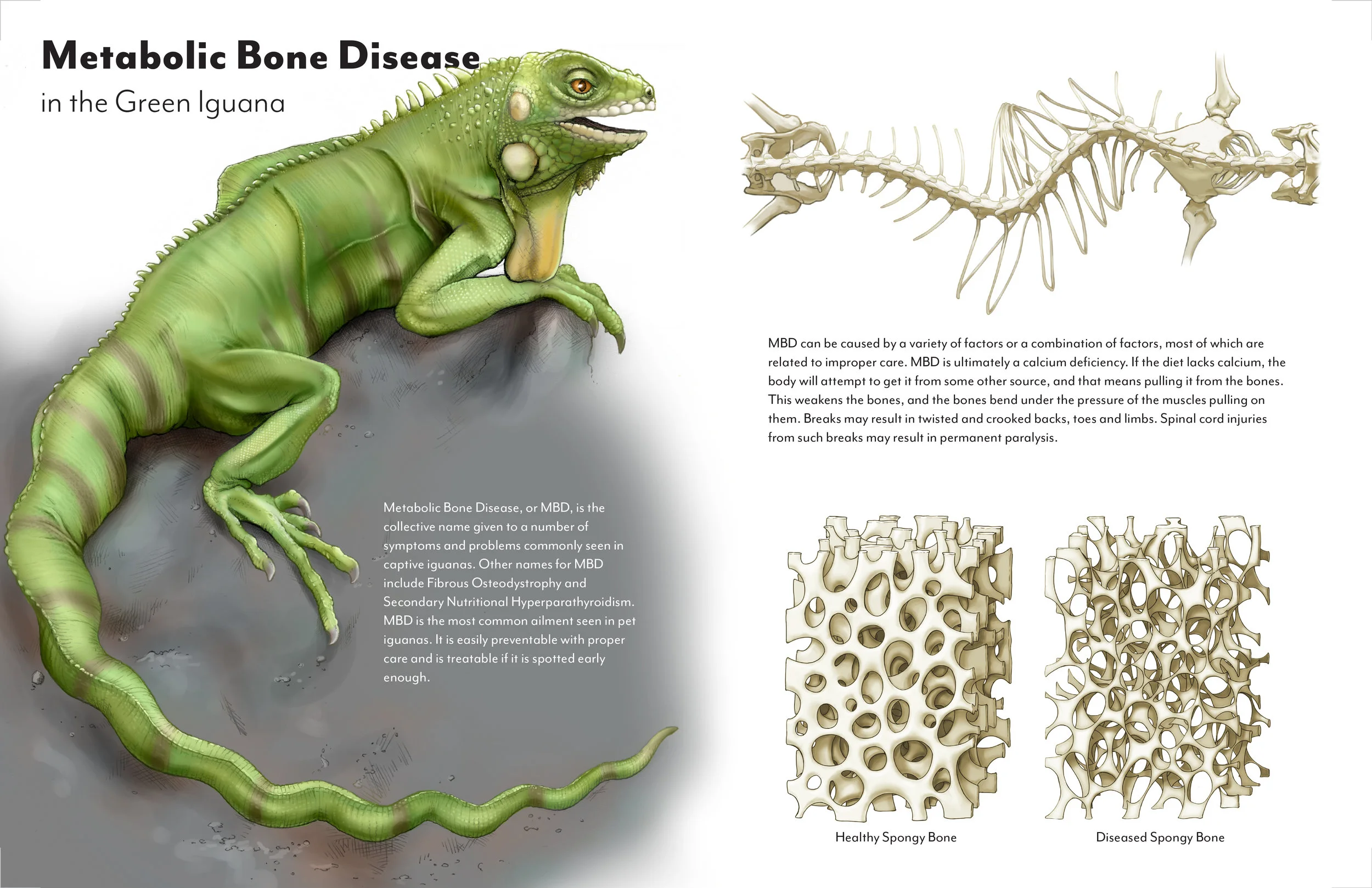 Metabolic Bone Disease