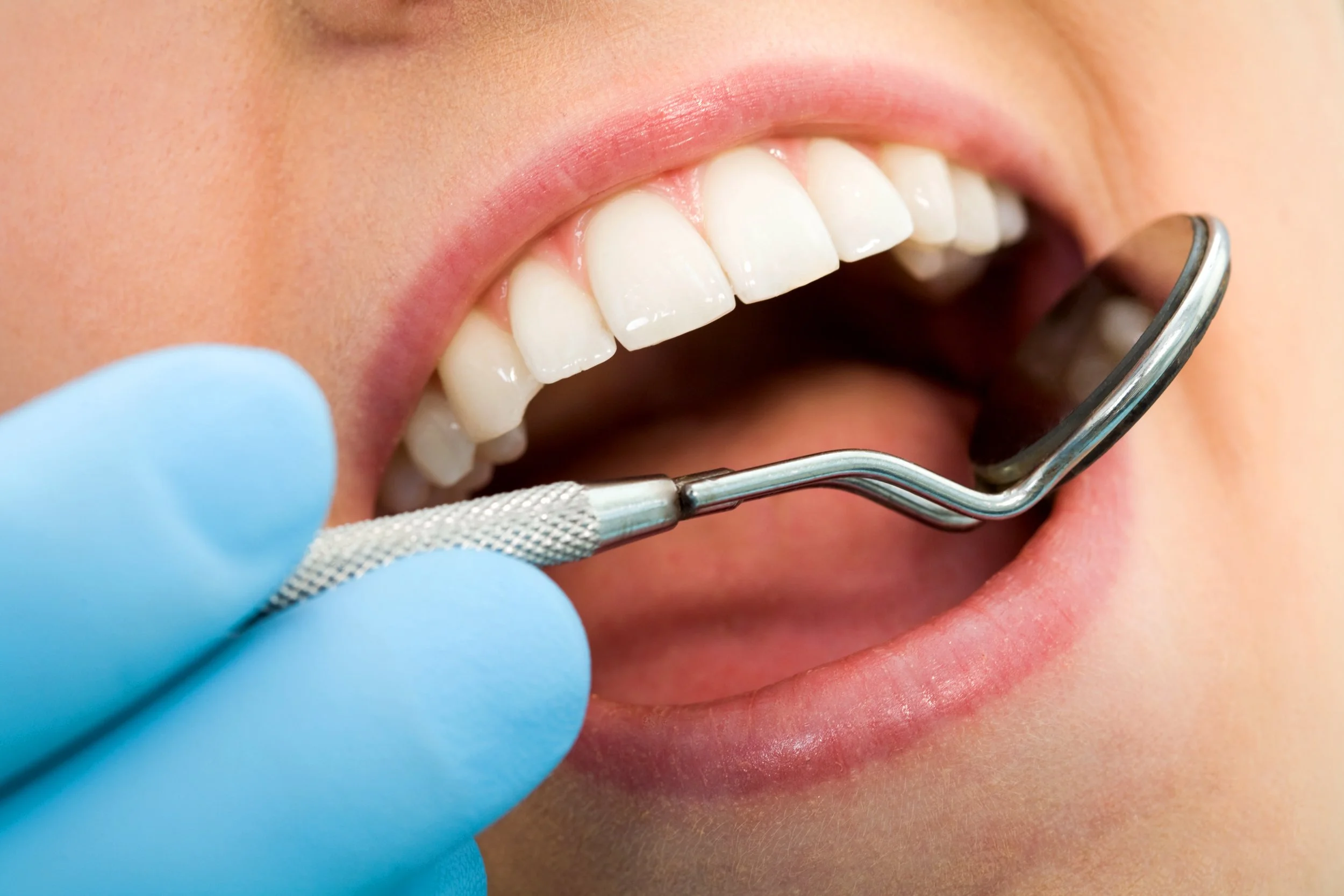 Why Do Your Gums Bleed When You Floss?
