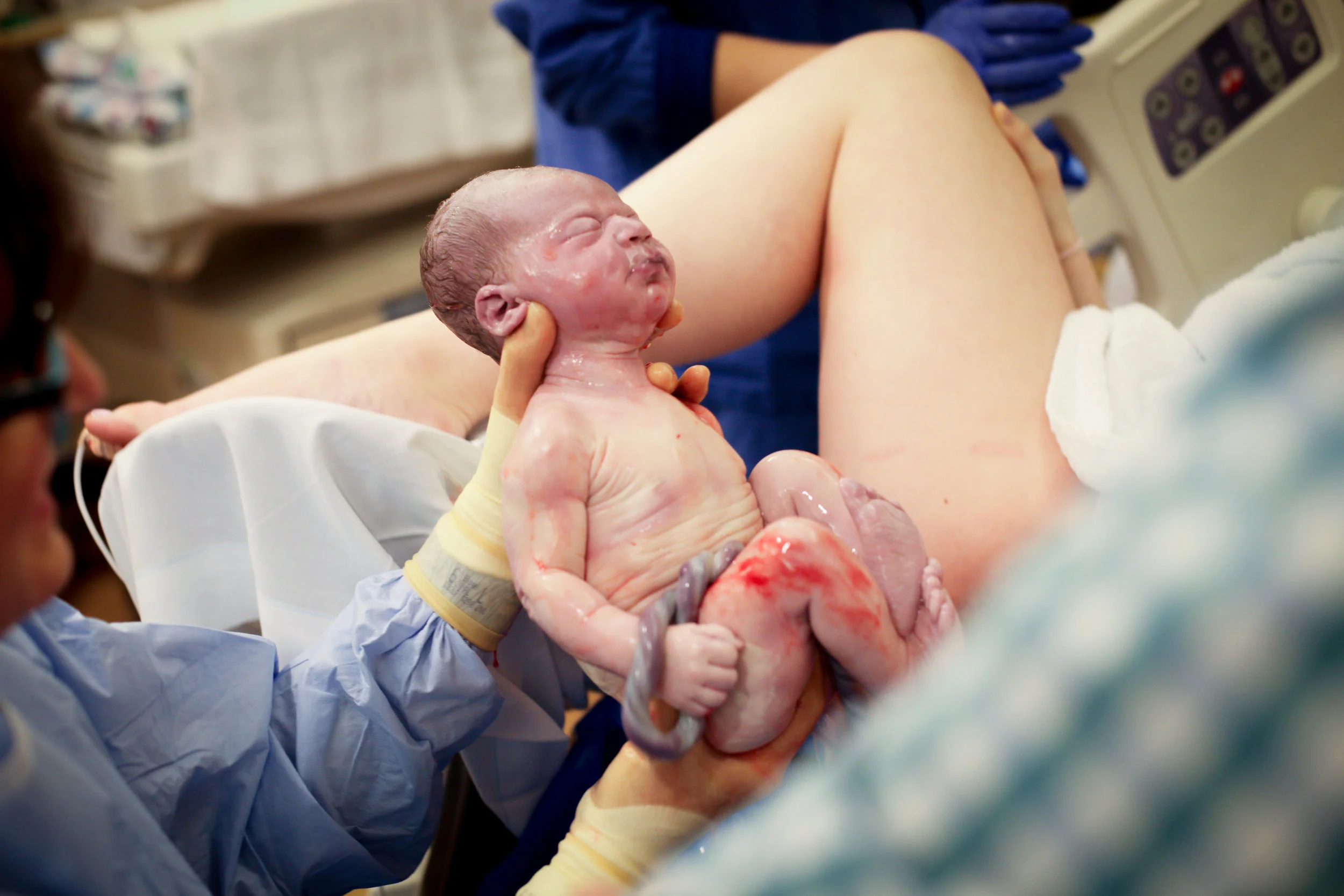 This is my favorite image from the bunch. Just look at that 1 second old baby! This one is best in color. I think the blood, the cord, baby's skin is really beautiful and needs to be seen.
