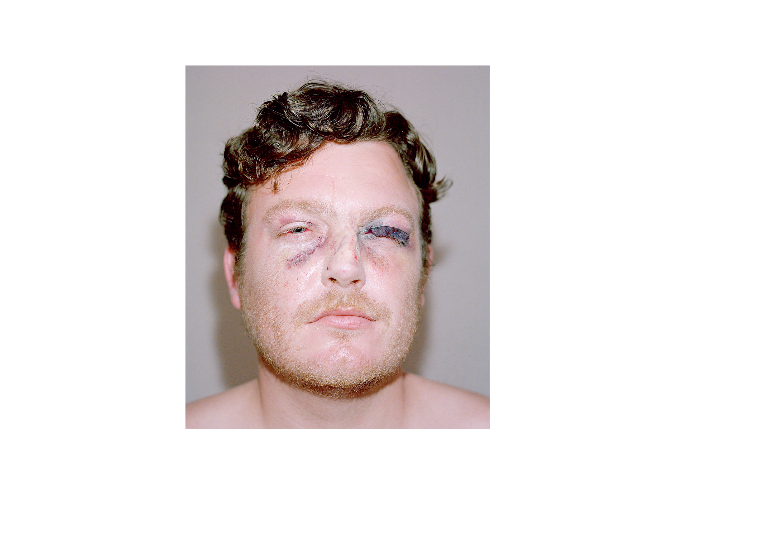  Reconstruction Of Dan’s Ordeal 