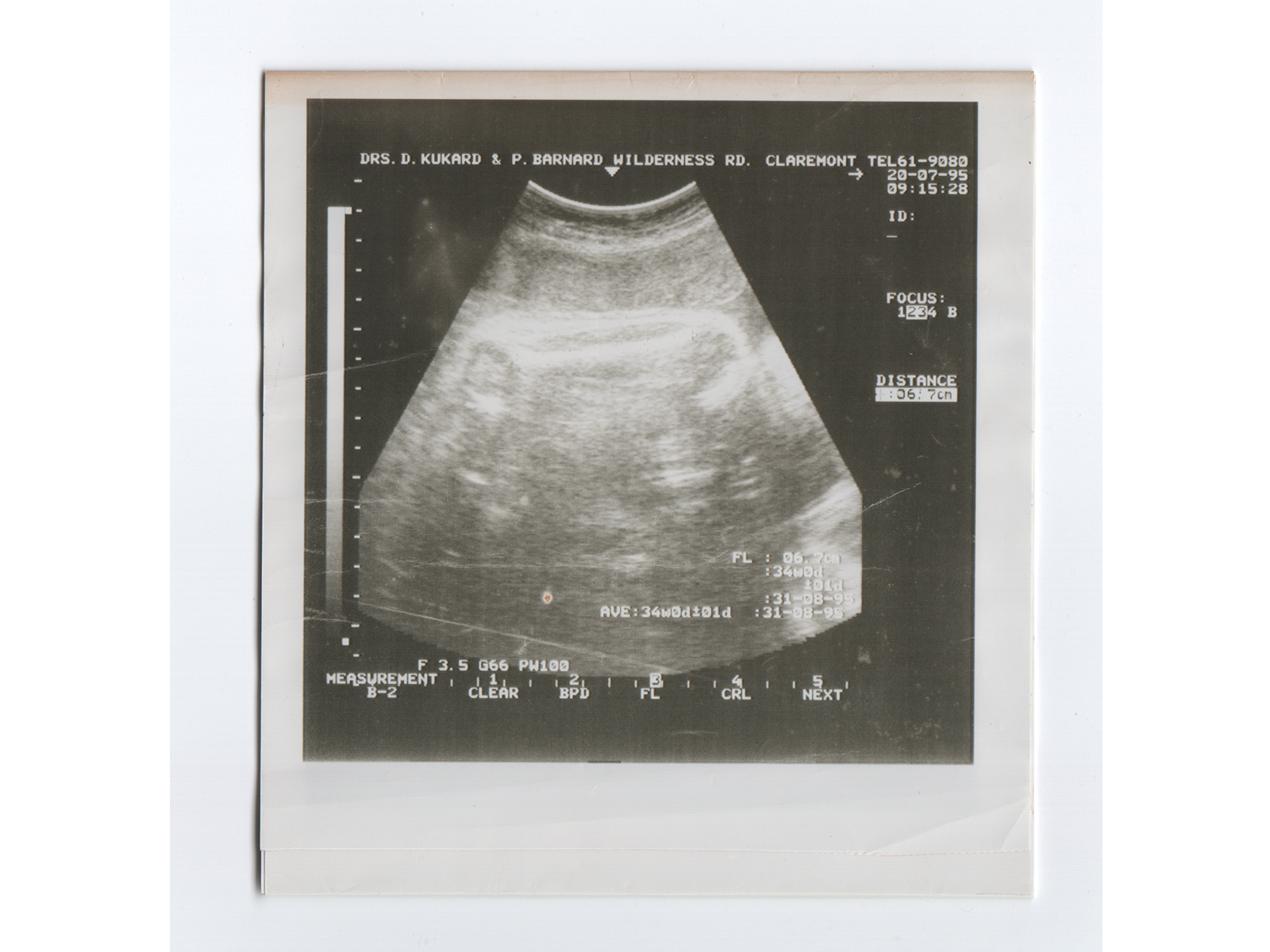  My Ultrasound 