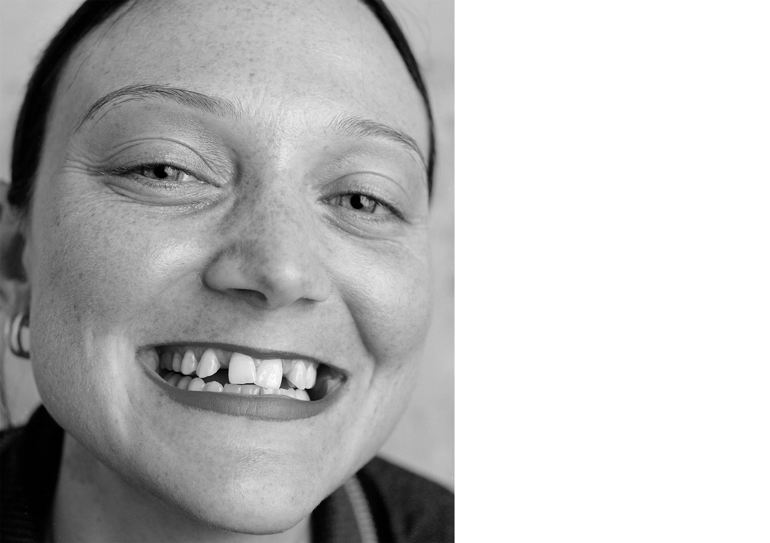  Anico Being Vulnerable  