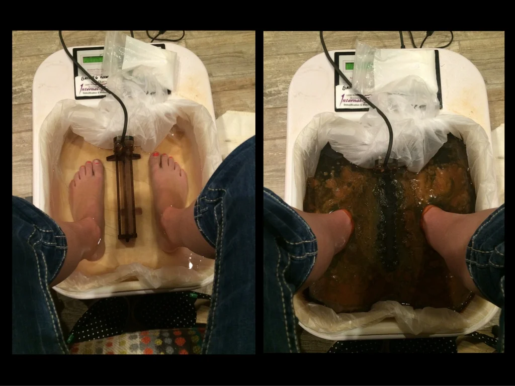 (Yep, those are my feet. Um...disgusting.)