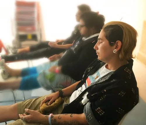 I was thrilled to be offer group acupuncture at the 2017 Trans Wellness and Wellbeing Conference