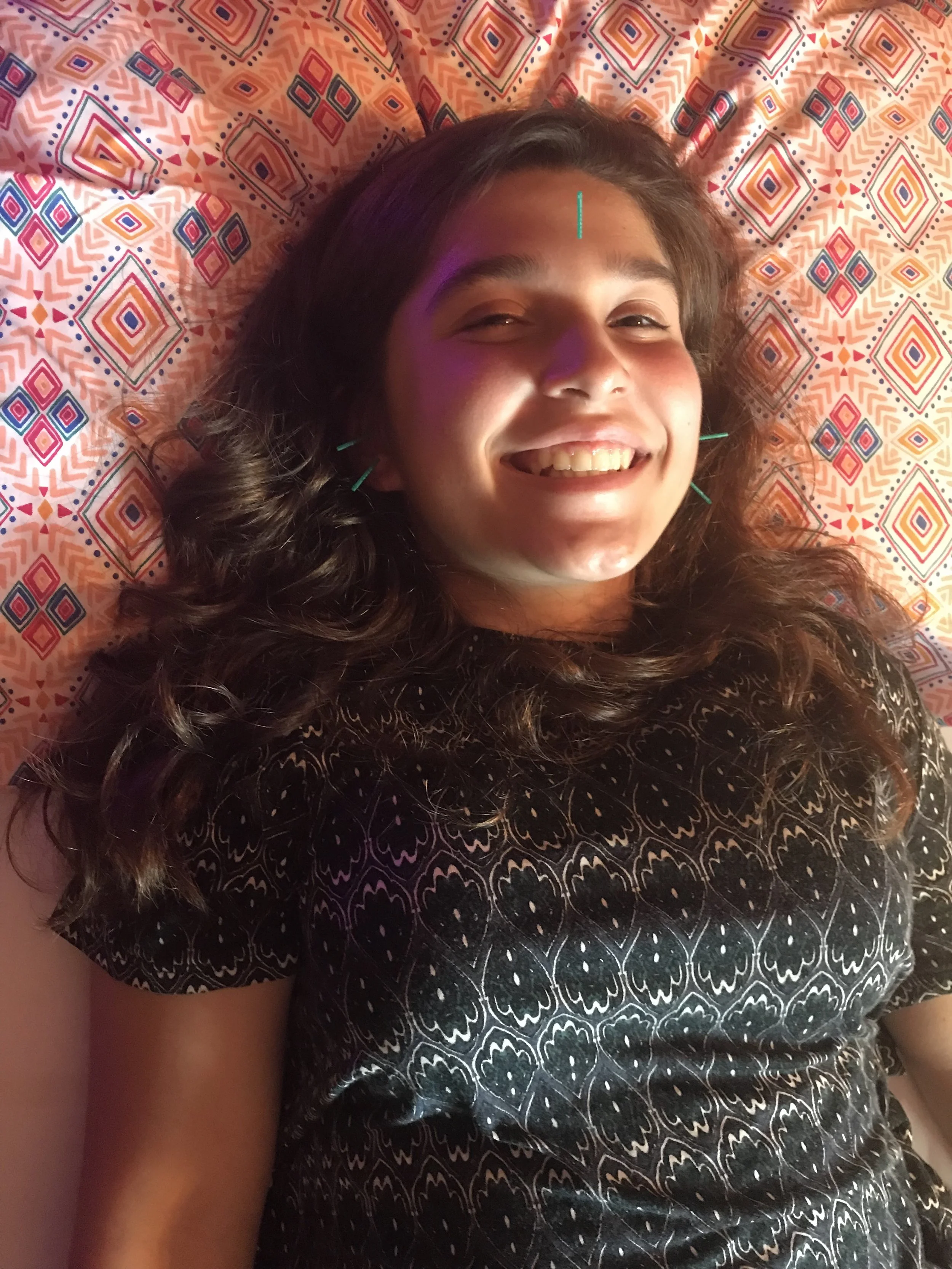 Teens love acupuncture