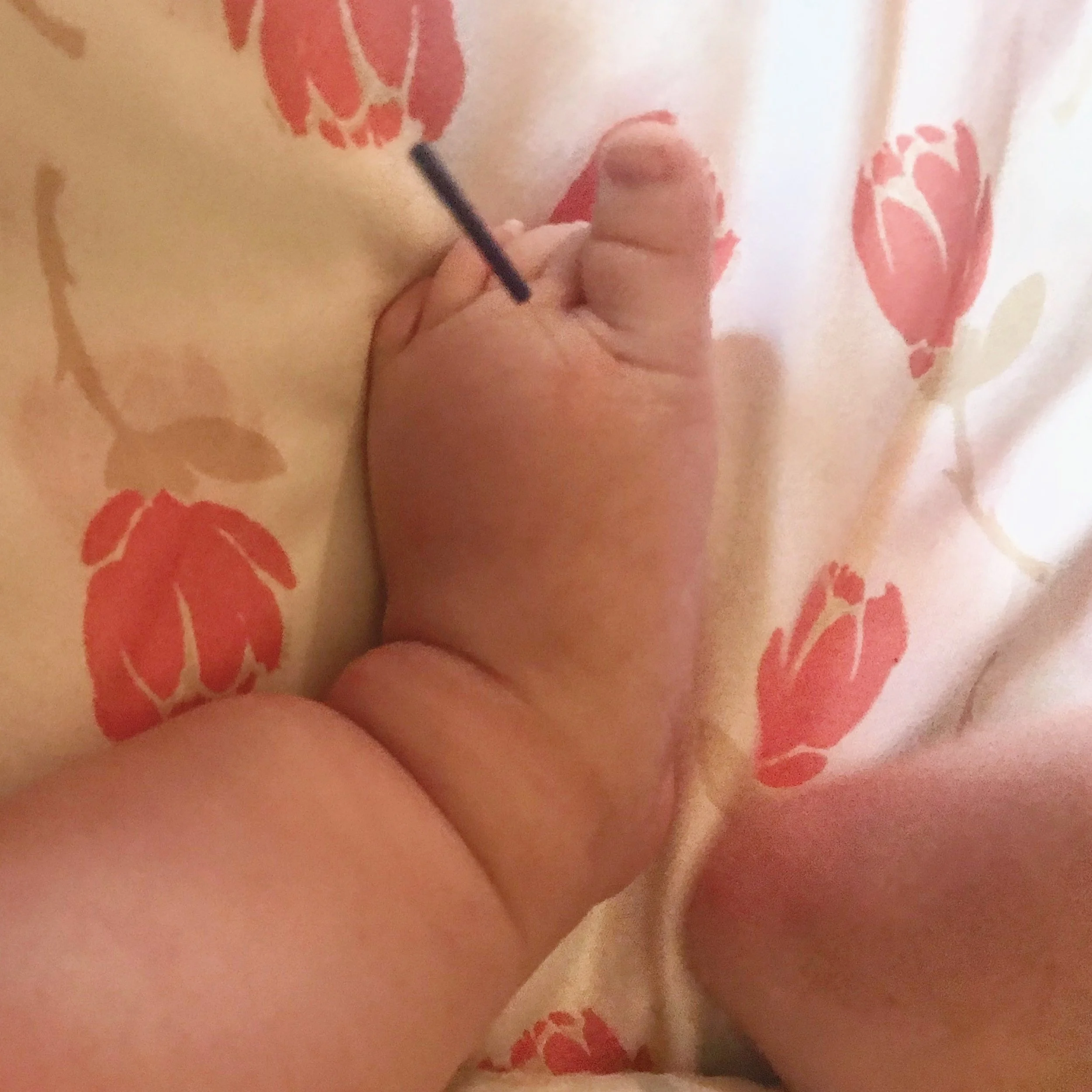 Baby Foot With Acupuncture Needle