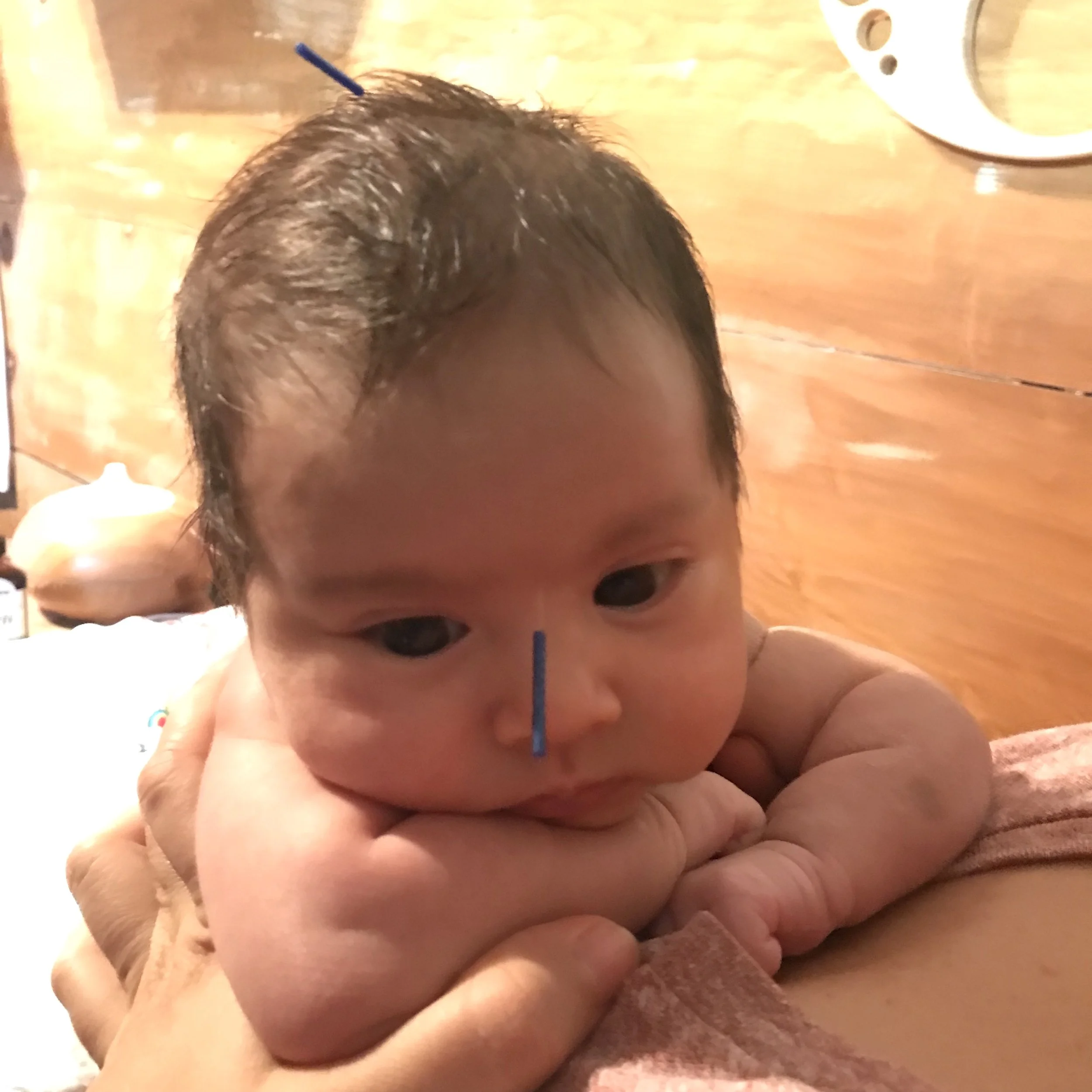 NEWBORN RELAXING WHILE BEING NEEDLED