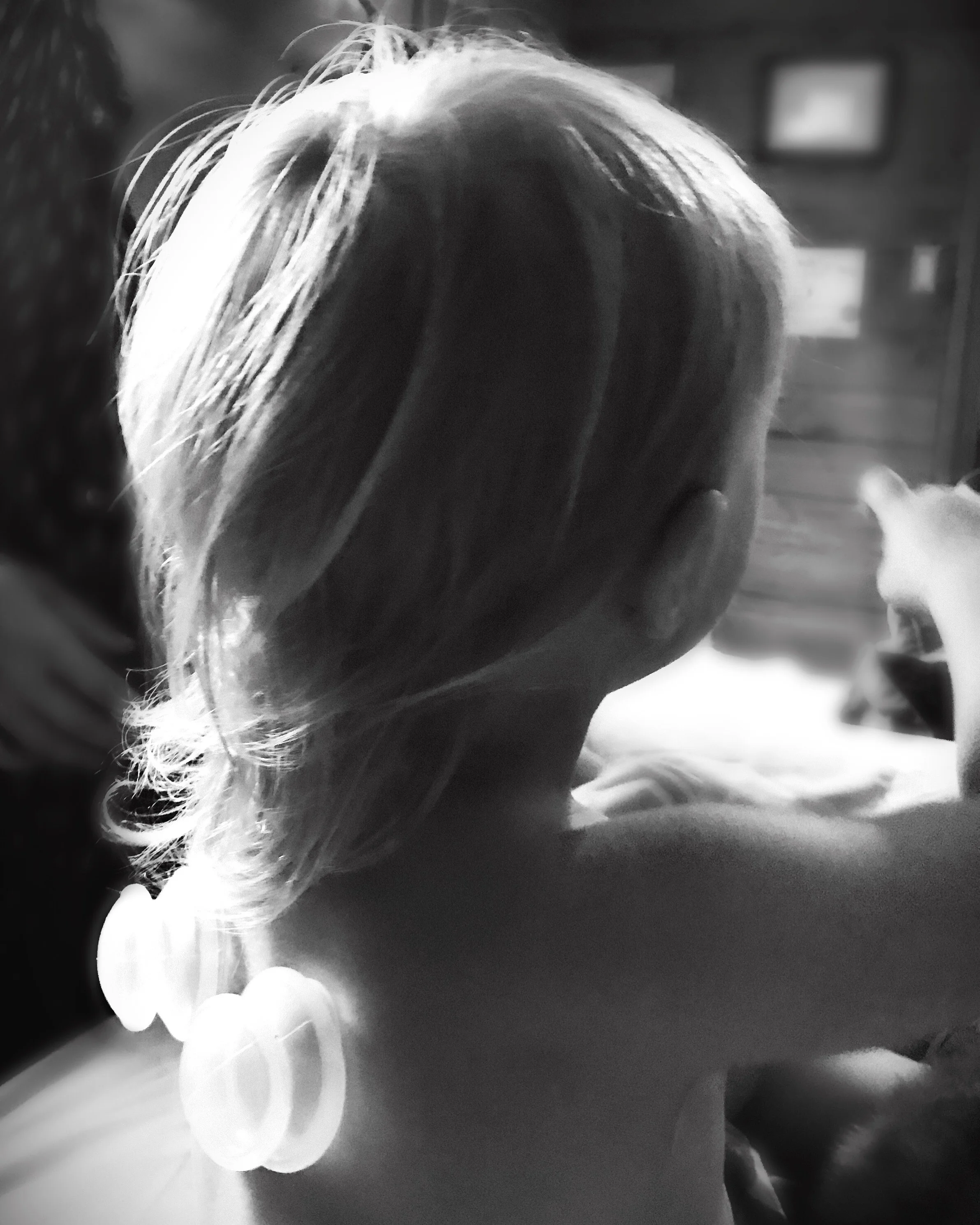 Toddler With Soft Cups on Back for Cough