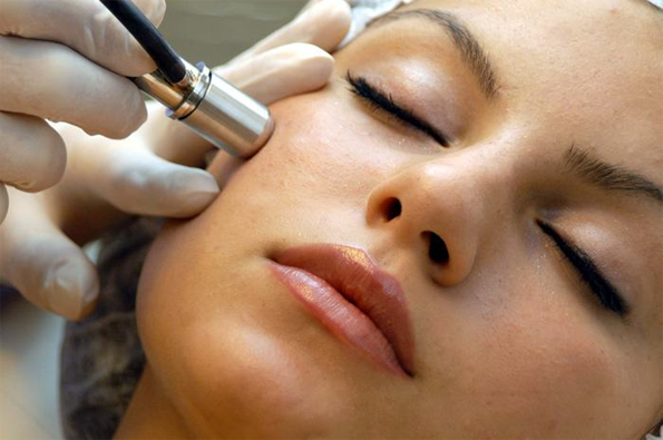 diamond-microdermabrasion.png