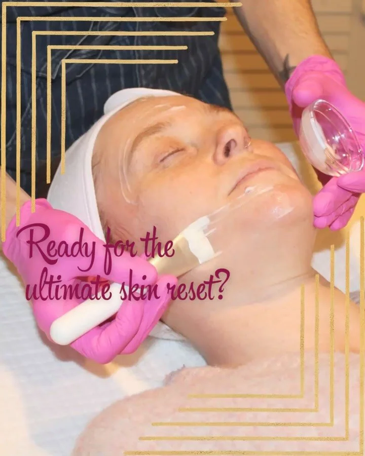 Environ Peel Progression Series: the ultimate reset for smoother, clearer, and healthier looking skin. 

Our Environ Cool Peels are powerful, progressive peels designed to visibly resurface, refine and support the skin without heat, peeling or downti