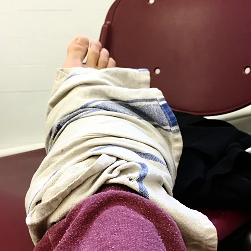 My foot after the fall