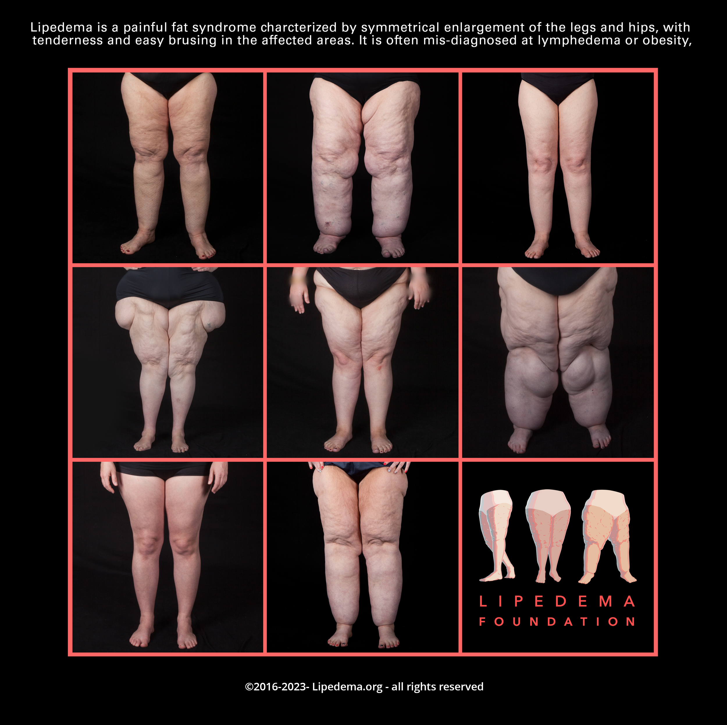 Legs_Symmetry_Collage_2023.png