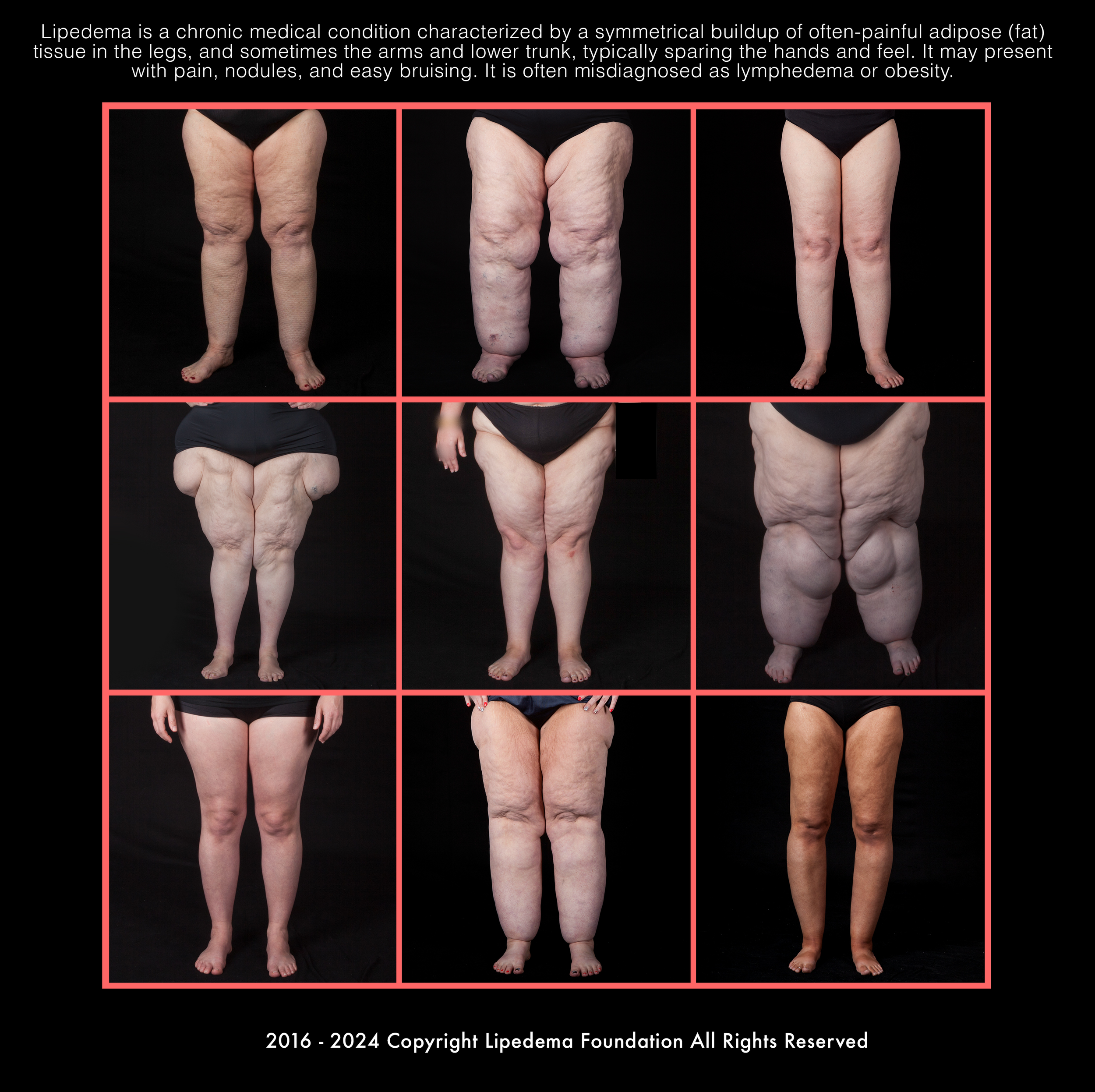 Legs_Symmetry_Collage_v3.png